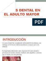 Caries Dental en El Adulto Mayor