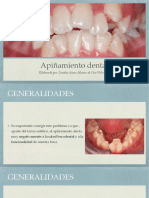 Apiñamiento Dental PDF