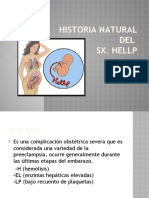 Historia Natural Del SX Hellp