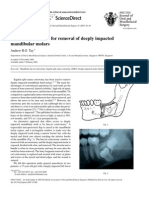 British Journal of Oral and Maxillofacial Surgery 45-1-83 84 Buccal Corticotomy For Removal of Deeply Impacted Mandibular Molars Tay