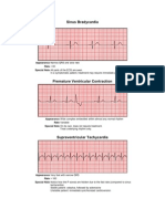 ACLS Rhythms