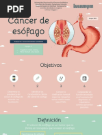 Cáncer de Esófago