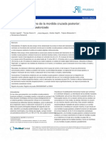 Tratamiento Temprano de La Mordida Cruzada Posterior: Un Ensayo Clínico Aleatorizado