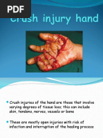 Crush Injury Hand