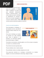 Sonda Nasogastrica