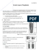 5-Différents Types D'implants DR Yousfi