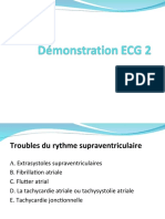 Cours 3 - Demonstrations 2-ECG LL 2020