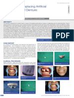 Natural Teeth Replacing