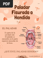 Paladar Hendido