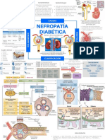 Nefropatía Diabética