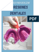 Protocolo de Impresiones Dentales