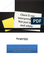 CXR Interpretation