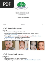 Cleft Lip and Cleft Palate: College of Health Science Department of Midwifery Course Newborn Care For Postbasic