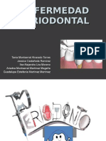 Enfermedad Periodontal