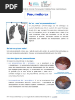 Fiche Pneumothorax