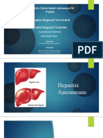 Hepatitis Autoinmne