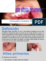 Estomatitis Aftosas Recurrente