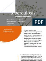 Tuberculosis