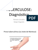 Tuberculose: Diagnóstico: Pâmela Carvalho Sérgio Dagostin