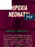 Hipoxia Neonatal