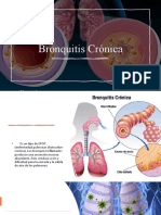 Bronquitis Crónica