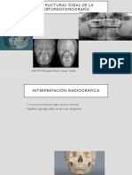 Estructuras Óseas de La Ortopantomografía: CDEO MO Benjamín Alberto Lázaro Castillo