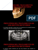 Principios Del Tratamiento de Los Dientes Retenidos