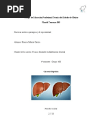 Cirrosis Hepatica