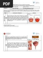 Cuadro Cistitis