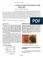 Analysis of Skin Cancer Image Processing Using MATLAB