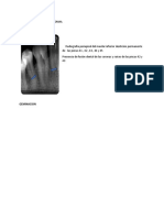 Anomalias Dentarias de Forma