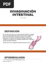 Invaginación Intestinal