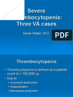 Thrombocytopenia Sarah Walter