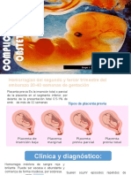 Complicaciones Obstétricas