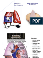 Managment of Pulmonary HTN Neonate