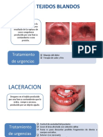 Trauma Dentoalveolar Ultima