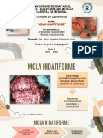 Mola Hidatiforme - Obstetricia Final