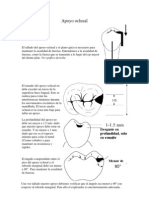 Apoyo Oclusal