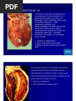 Isquemia, Infarto, Insuficiencia, Shock