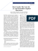 Failed Root Canals The Case For Extraction and Immediate Implant Placement