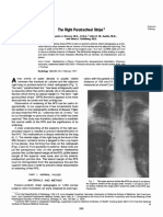 The Right Paratracheal Stripe: Maj. Charles J. Savoca, M.C., U.S.A., John H. M. Austin, M.D., and Henry I. Goldberg, M.D