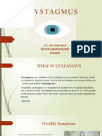 NYSTAGMUS