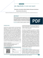 Nonsyndromic Oligodontia A Rare Case Report