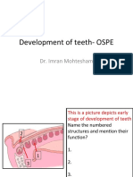 Deve of Tooth OSPE With Answers