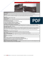 SHRH Flyash Erosion