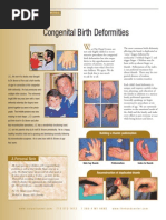 Congenital Birth Deformities