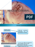 Absceso Cerebral