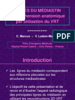 LIGNES DU MÉDIASTIN Compréhension Anatomique Par Utilisation Du VRT