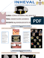 Cementación Adhesiva - Grupo 5