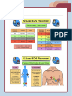 ECG Placement